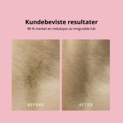 Kitchik Trimme Pro 2.0